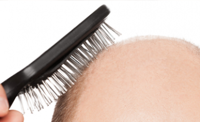 hair loss causes