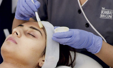 chemical peel treatment in mumbai