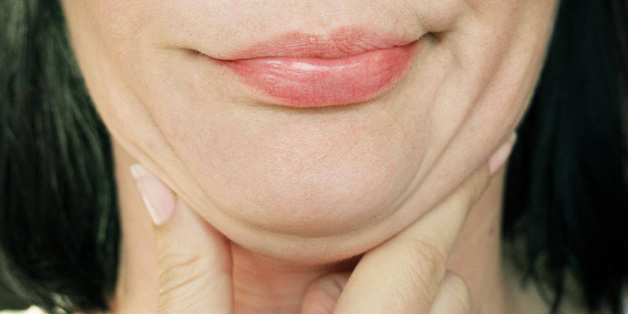 Double Chin Reduction Treatment