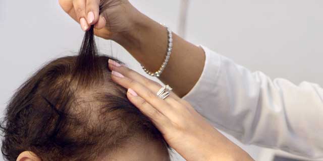 Hair Loss Treatments in Mumbai | Hair Specialist in Mumbai | Dr. Batul Patel