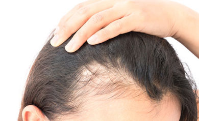 Hair Transplant Treatments