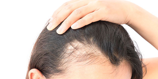 Hair Transplant Treatments