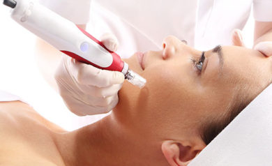 Microneedling Treatment