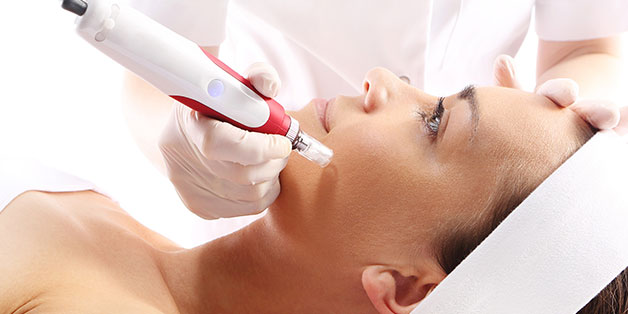 Microneedling Treatment