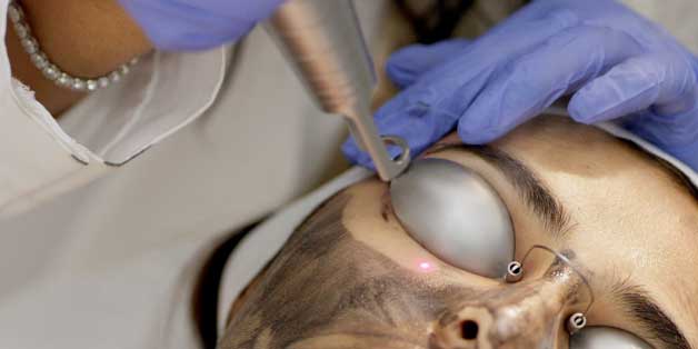 Laser Skin Resurfacing