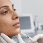 Chin_Filler_treatment