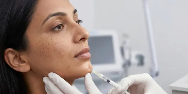 Chin_Filler_treatment