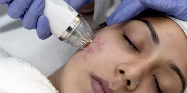 MnRF_Treatment